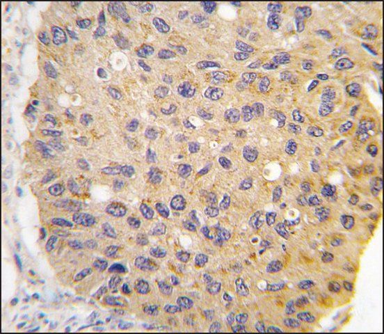 Anti-GHRH (center) antibody produced in rabbit