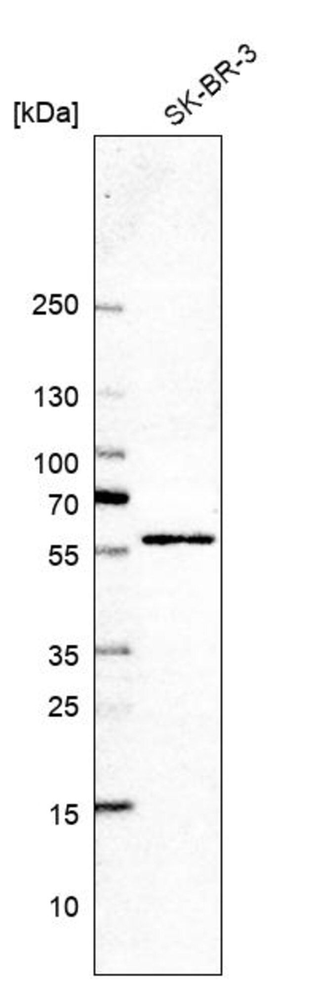 Anti-GHDC antibody produced in rabbit