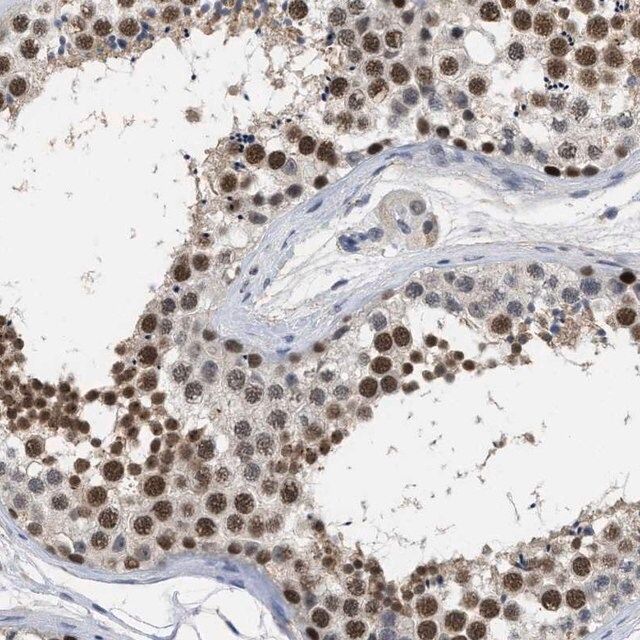 Anti-GGNBP2 antibody produced in rabbit