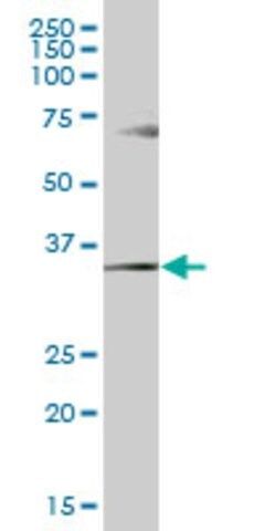 Anti-GGPS1 antibody produced in mouse