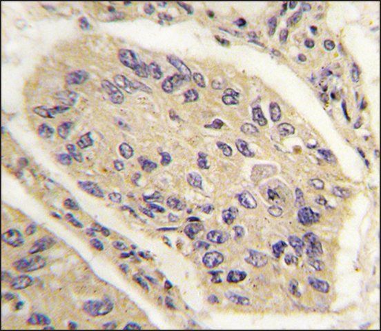 Anti-GHRH (N-term) antibody produced in rabbit