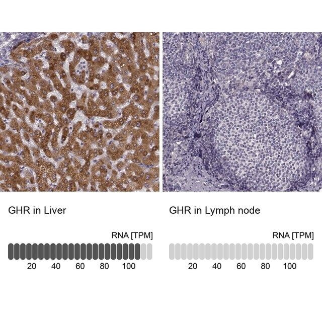 Anti-GHR antibody produced in rabbit