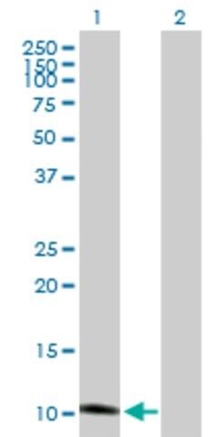 Anti-GHRH antibody produced in mouse