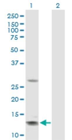 Anti-GHRH antibody produced in rabbit