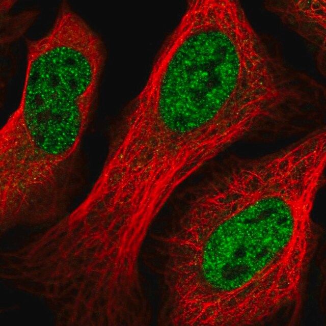 Anti-GID8 antibody produced in rabbit