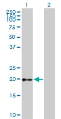 Anti-GH1 antibody produced in mouse