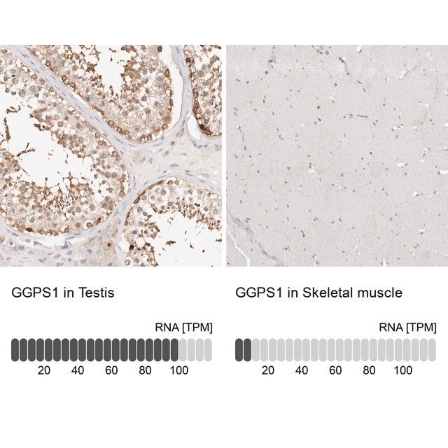 Anti-GGPS1 antibody produced in rabbit