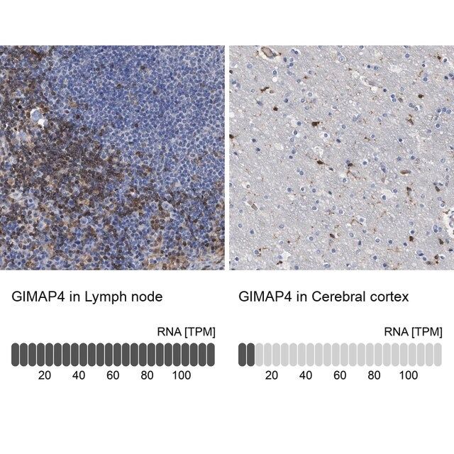 Anti-GIMAP4 antibody produced in rabbit