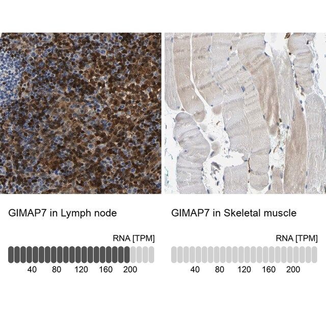 Anti-GIMAP7 antibody produced in rabbit