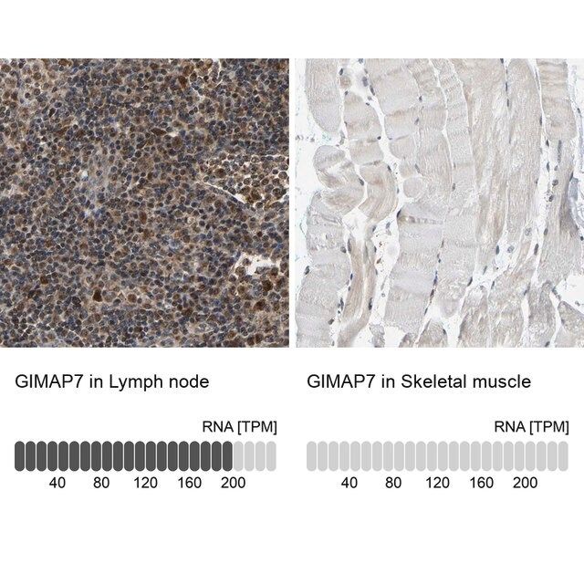 Anti-GIMAP7 antibody produced in rabbit