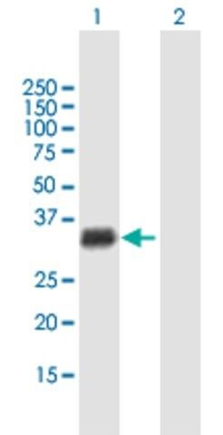 Anti-GIYD2 antibody produced in mouse