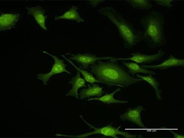 Anti-GIT2 antibody produced in rabbit