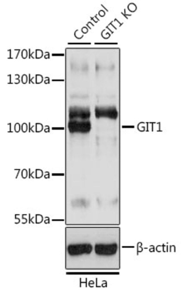 Anti-GIT1 antibody produced in rabbit