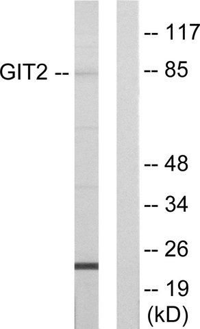 Anti-GIT2 antibody produced in rabbit