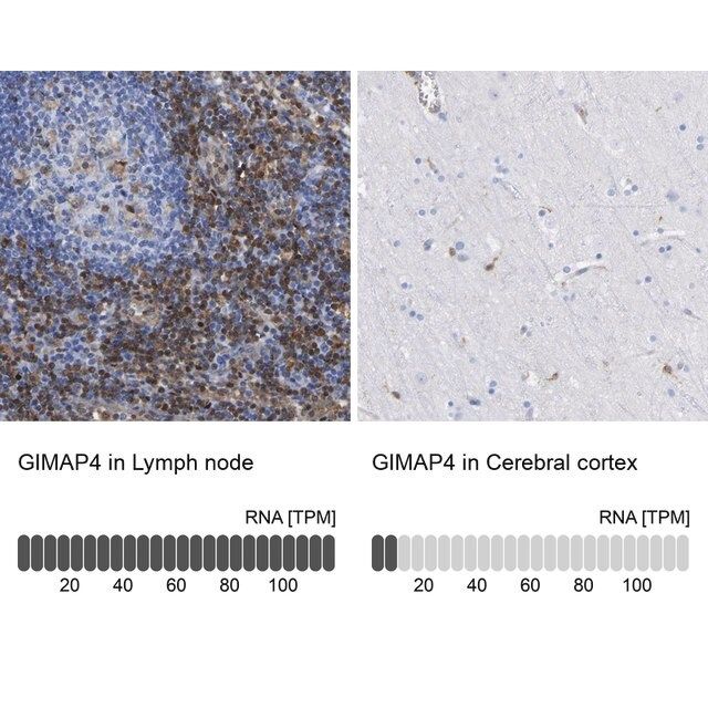 Anti-GIMAP4 antibody produced in rabbit