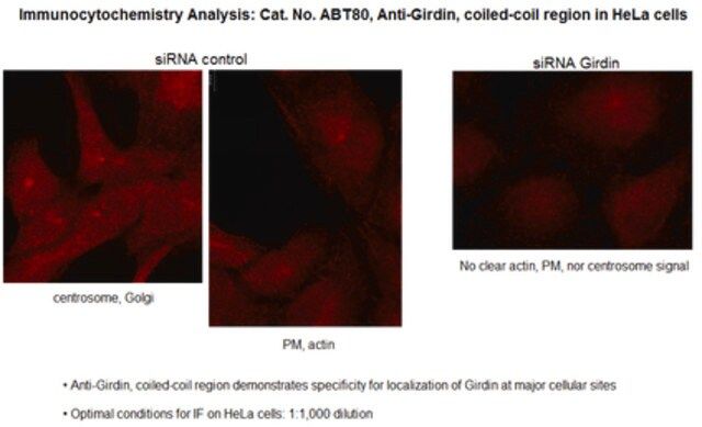 Anti-Girdin, coiled-coil region Antibody