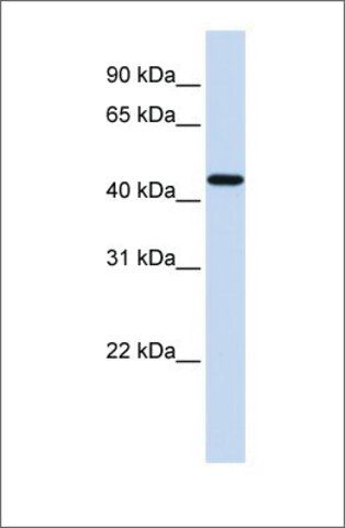 Anti-F2R antibody produced in rabbit