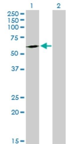 Anti-FPGT antibody produced in mouse