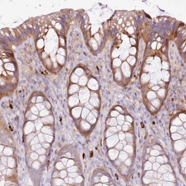 Anti-FPR1 antibody produced in rabbit