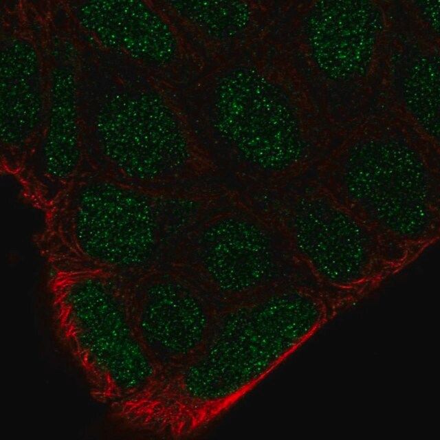 Anti-FRK antibody produced in rabbit