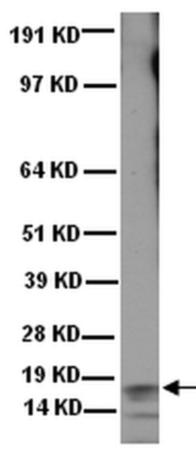 Anti-Frataxin Antibody, exon 4, clone 1G2