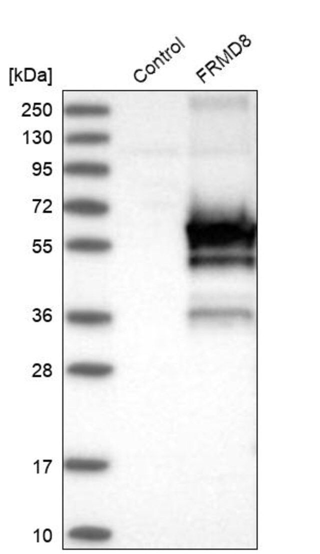 Anti-FRMD8 antibody produced in rabbit