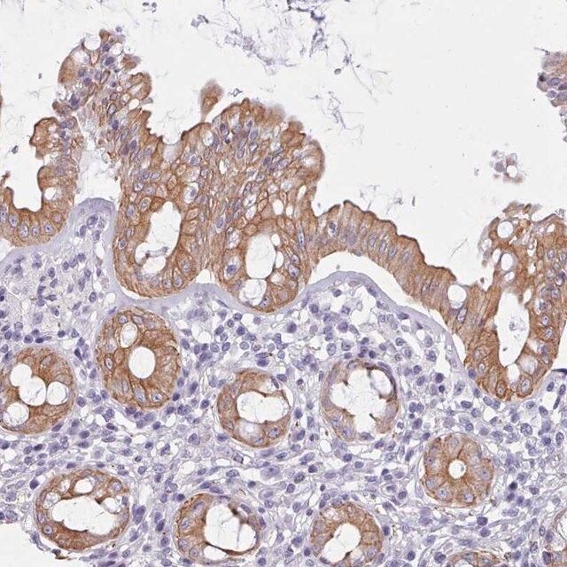 Anti-FPGS antibody produced in rabbit