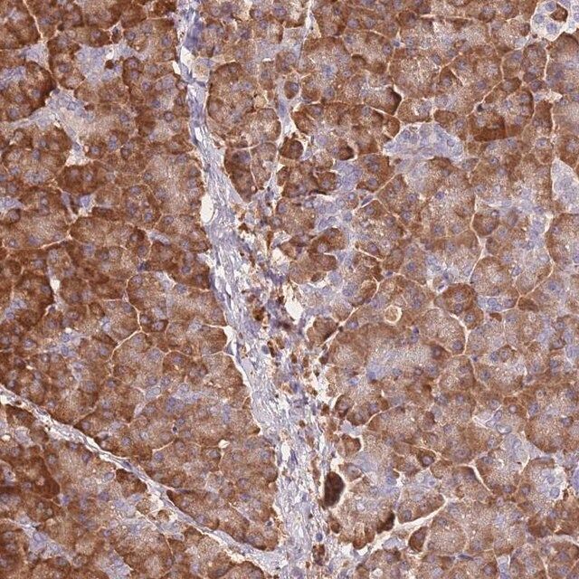 Anti-FRAT2 antibody produced in rabbit