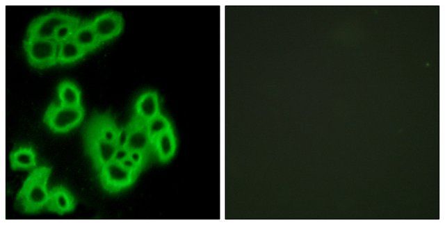 Anti-FPR1 antibody produced in rabbit