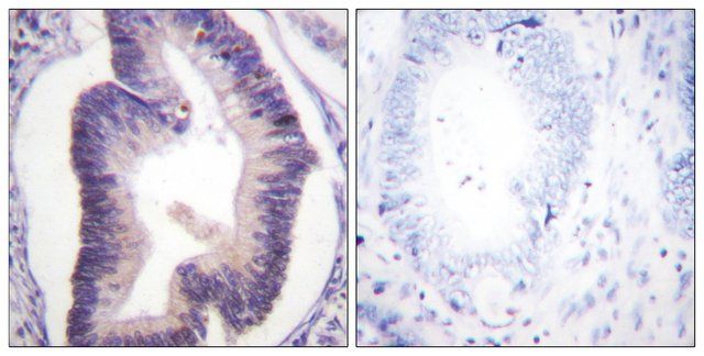 Anti-Fructose 6 Phosphate Kinase antibody produced in rabbit