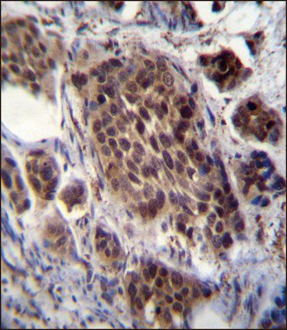 ANTI-FRAT2 (C-TERM) antibody produced in rabbit