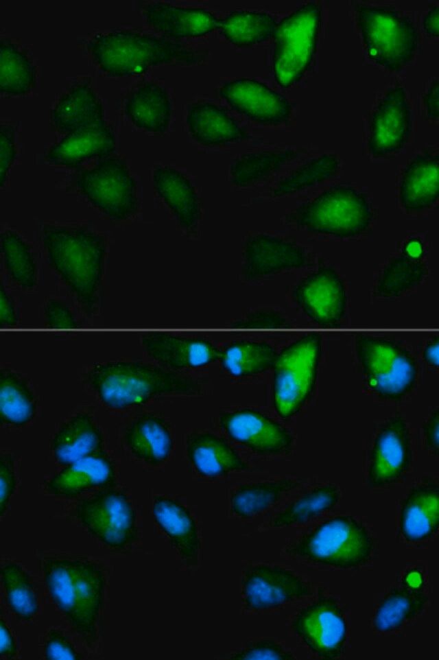 Anti-F11R antibody produced in rabbit