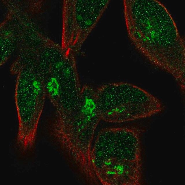 Anti-FPR1 antibody produced in rabbit