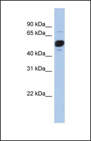 Anti-FRS3 antibody produced in rabbit