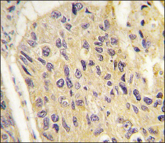 Anti-FRAT1 (C-term) antibody produced in rabbit