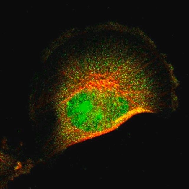 Anti-FRMD8 antibody produced in rabbit