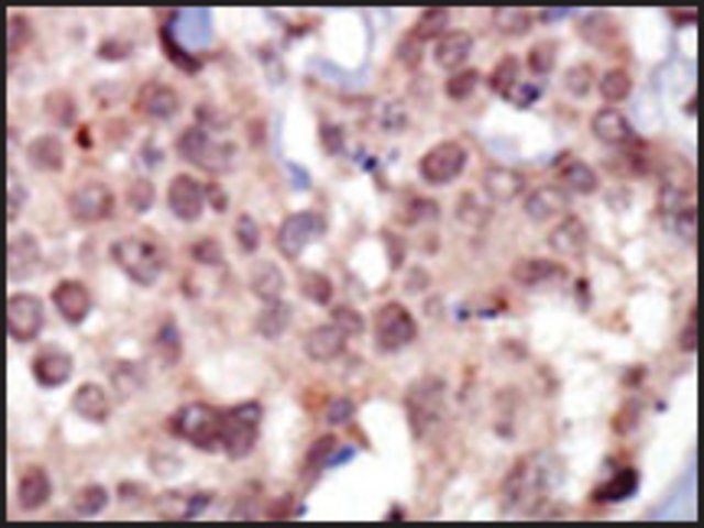 Anti-FRK (N-term) antibody produced in rabbit