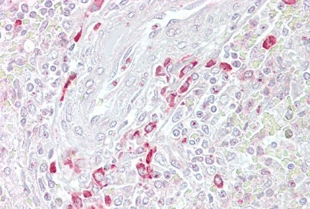 Anti-FRZB antibody produced in rabbit