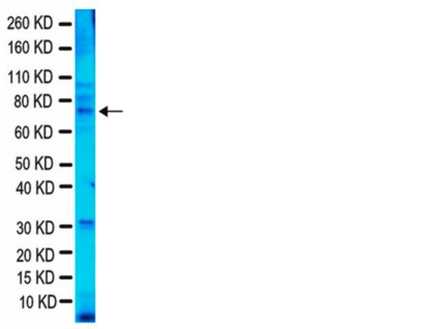 Anti-Fragile X Mental Retardation Protein Antibody, clone 1C3