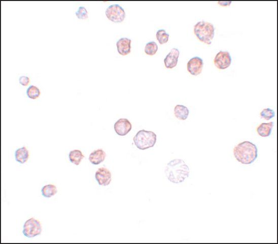 Anti-FREM1 antibody produced in rabbit