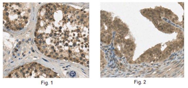 Anti-FSH, -subunit Antibody