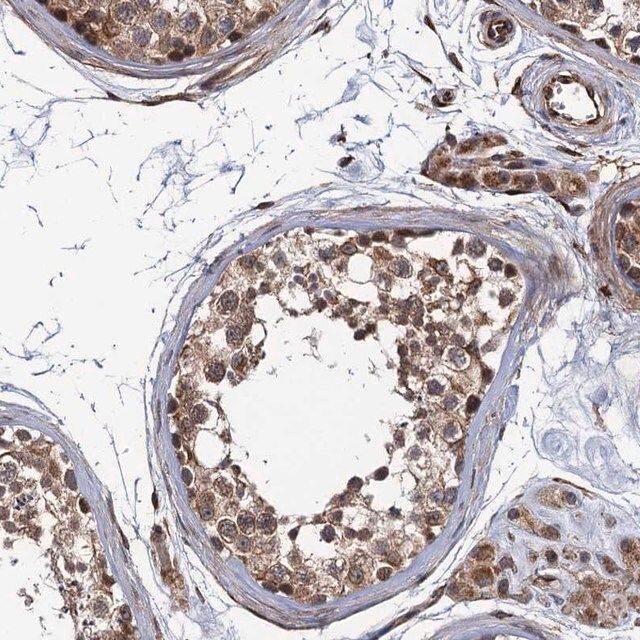 Anti-FSIP1 antibody produced in rabbit