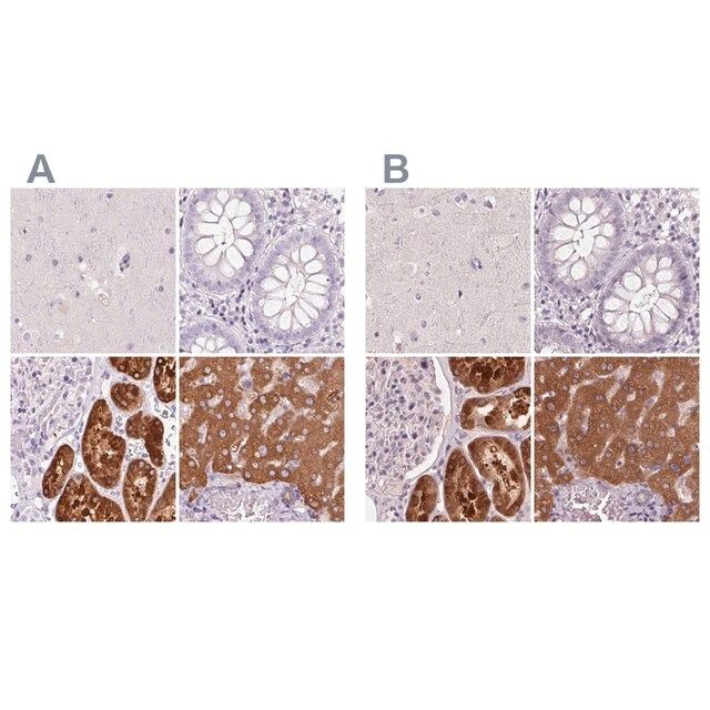 Anti-FTCD antibody produced in rabbit