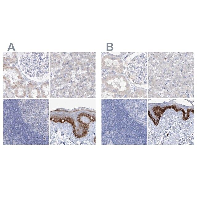 Anti-FRS3 antibody produced in rabbit