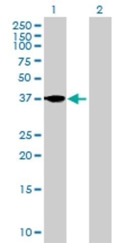 Anti-FST antibody produced in mouse