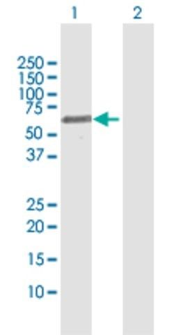 Anti-FSD1 antibody produced in rabbit