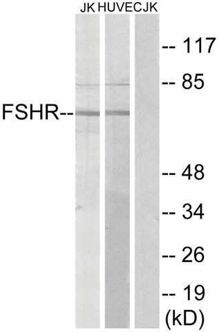 Anti-FSHR antibody produced in rabbit