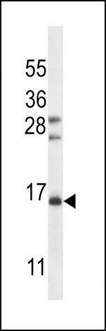 ANTI-FSHB/FSH (CENTER) antibody produced in rabbit