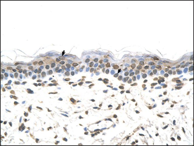 Anti-FTCD antibody produced in rabbit