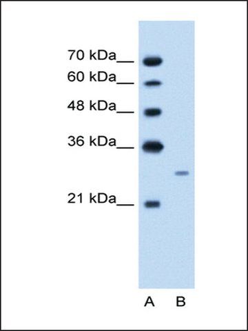 Anti-FST antibody produced in rabbit